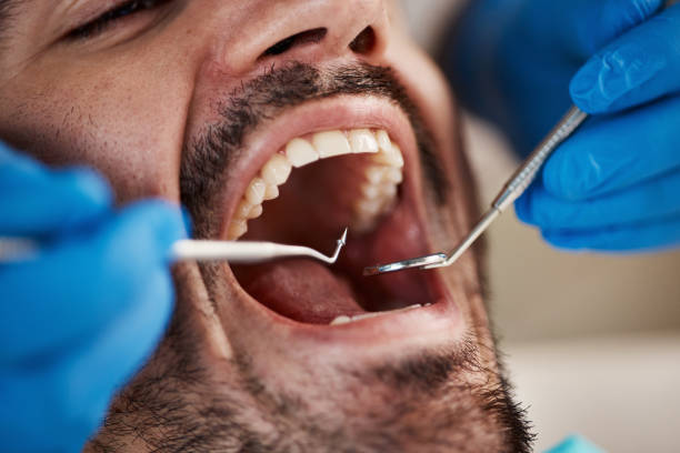 Best Emergency Gum Treatment in West Sharyland, TX