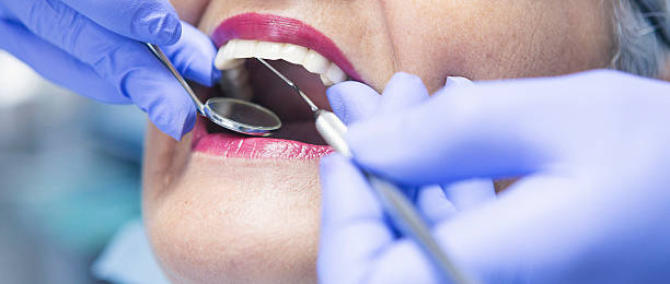 Best Emergency Tooth Extraction in West Sharyland, TX